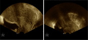 Fig. 6
