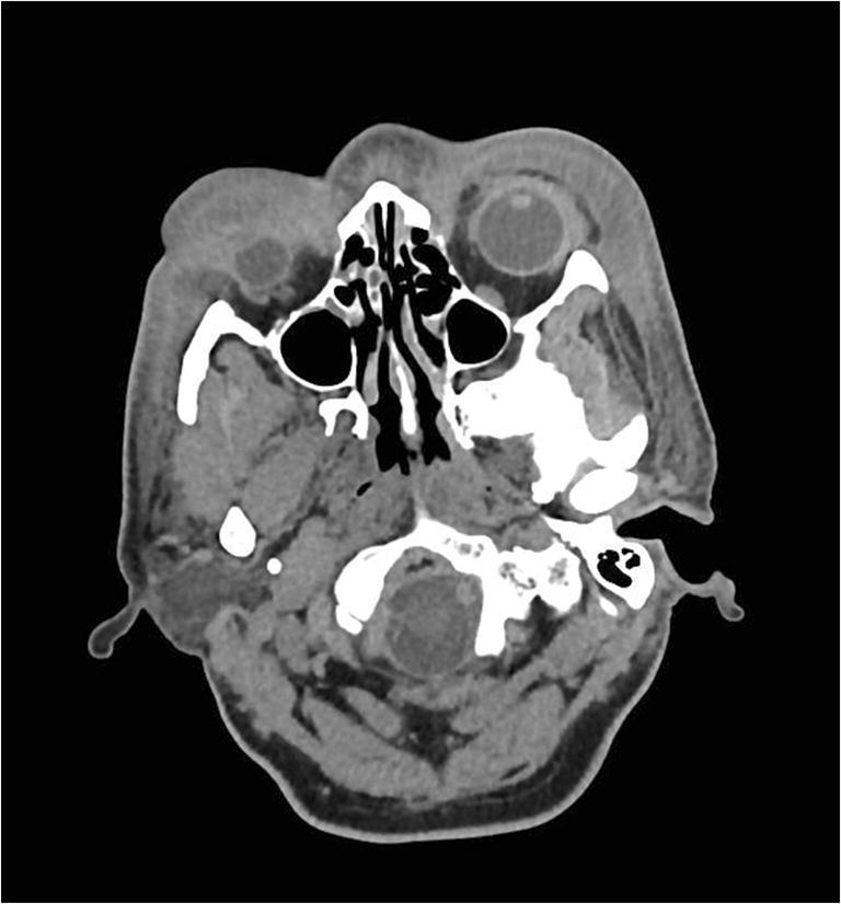 Fig. 11