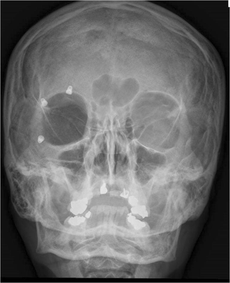 Fig. 8