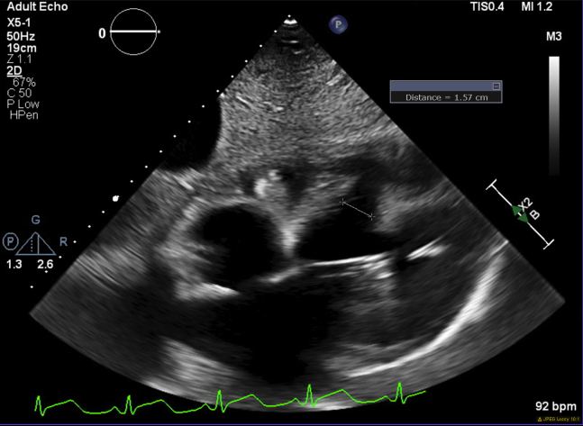 Figure 3