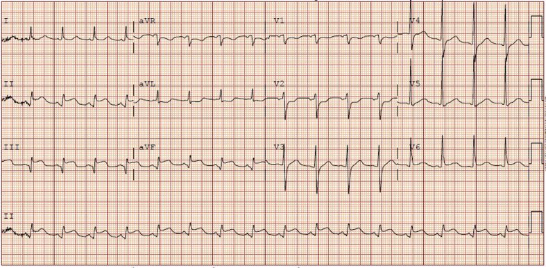 Figure 1