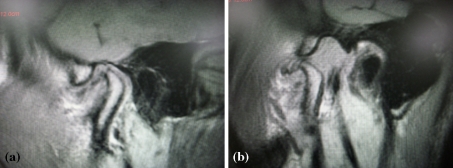 Fig. 5