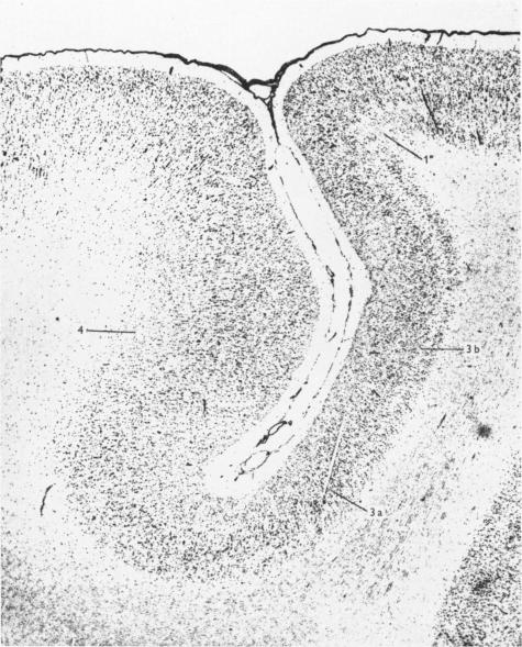 Plate 1