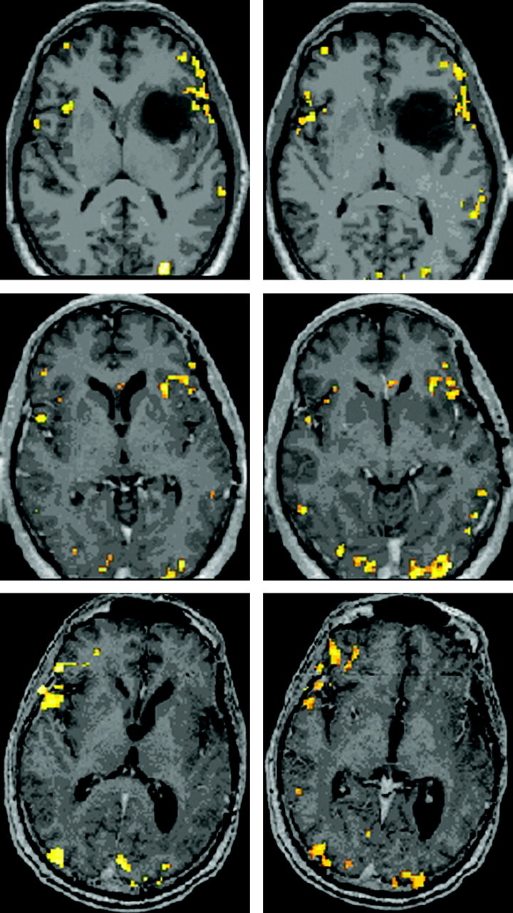 Fig 2.