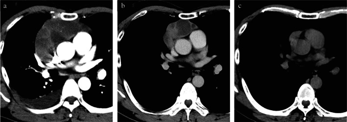 FIGURE 1