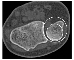 Fig. (1b)