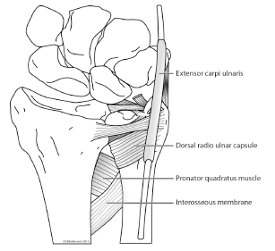 Fig. (2)