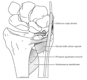 Fig. (2)