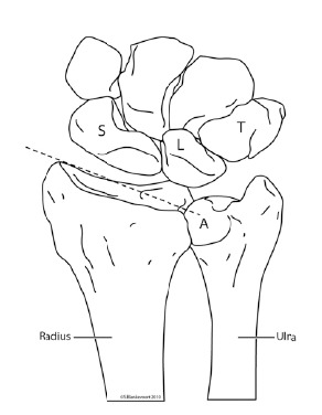 Fig. (1a)