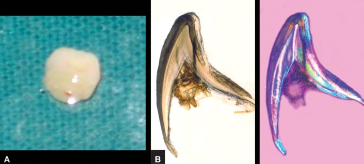 Figs 3A and B: 