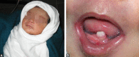 Figs 1A and B: