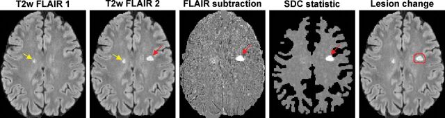 Fig 1.