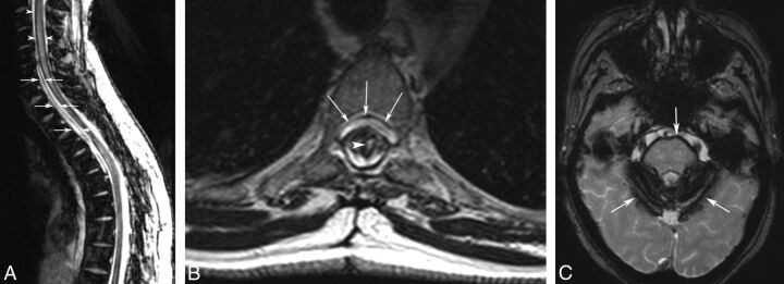 Fig 3.