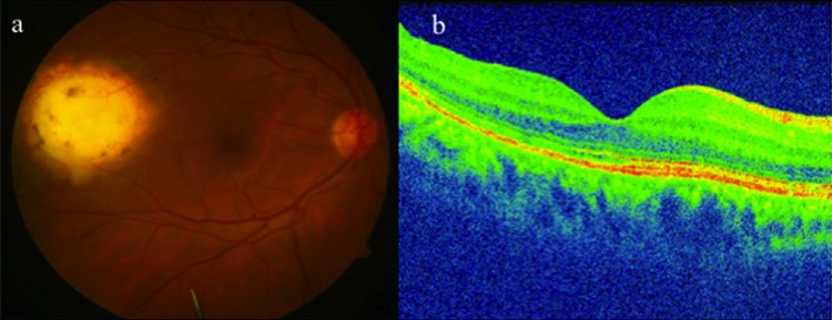 Figure 3