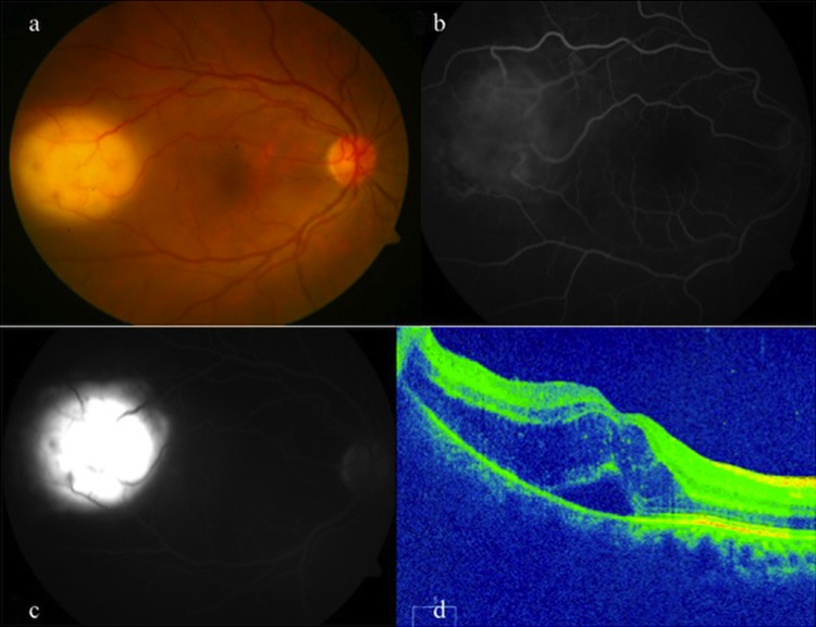 Figure 2