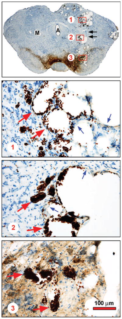 Fig. 2