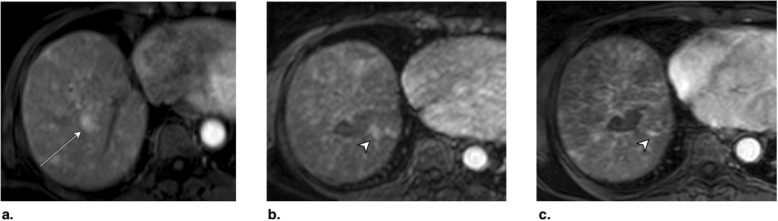 Fig. 15