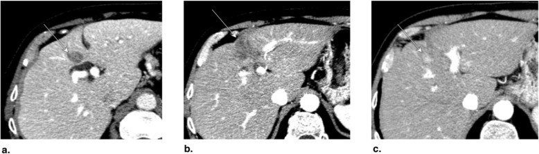 Fig. 10