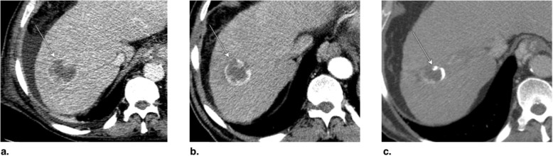 Fig. 26