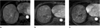 Fig. 15