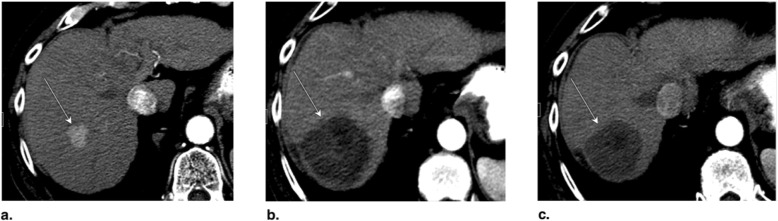 Fig. 14