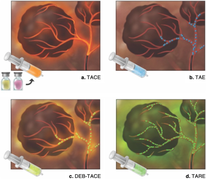 Fig. 18