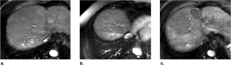 Fig. 24