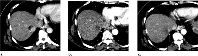 Fig. 25