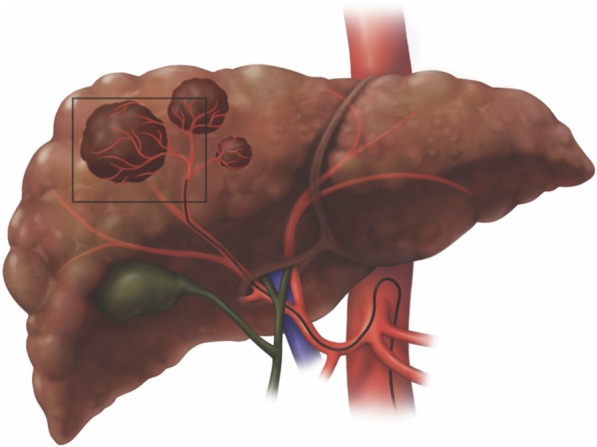 Fig. 17