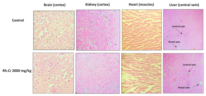 Figure 15