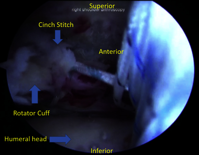 Fig 6