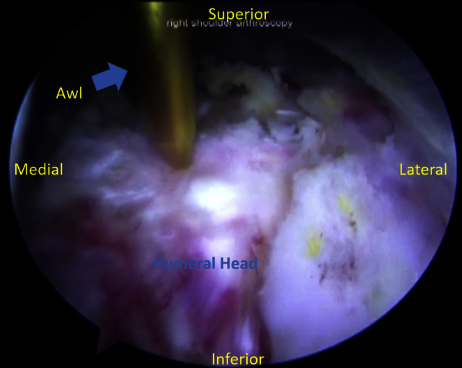 Fig 10