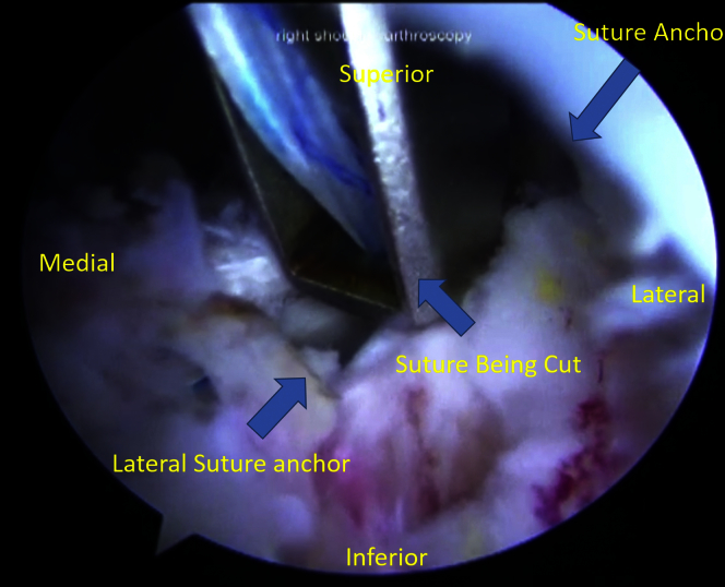 Fig 12