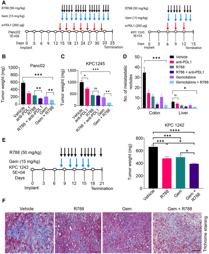 Figure 4. Syk inhibition reduces tumor growth and sensitizes PDAC tumors to gemcitabine. A, Schemas for the administration of R788 or anti-PDL1 mAb or Gem in Panc02 or KPC1245 tumors. B and C, Weights of pancreata from Panc02 (B) and KPC1245 (C) tumors treated with drugs (n = 5) as depicted in schema in A. D, Metastatic nodules in treated KPC1245 (n = 5) PDAC tumors. Significance testing was performed by one-way ANOVA with Tukey post hoc multiple pairwise testing. E, Weights of pancreata from KPC1242 tumors treated with drugs (n = 5) as depicted in schema. F, Images showing Trichrome staining in PDAC tumors. Scale bar, 50 μm. *, P < 0.05; **, P < 0.01; ***, P < 0.001; ****, P < 0.0001; ns, not significant.