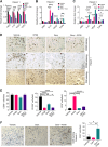 Figure 7. R788 reduces the expression of markers associated with immunosuppressive TAMs and augments immunostimulatory responses in human PDAC slice culture ex vivo. A–C, Relative mRNA expression of immunosuppressive genes in the human PDAC slices treated with either 250 nmol/L Gem and/or 2.5 μmol/L R788 from patient 1 (A), patient 2 (B), and patient 3 (C). Significance testing was performed by one-way ANOVA with Tukey post hoc multiple pairwise testing. D and E, IHC (D) of human PDAC slices derived from donor 1 for CD206+, CD68+ macrophages, and CD8+ T cells (scale bar, 20 μm) and quantification (E) of CD68+, CD206+, and CD8+ cells/40× field. F, IHC of human PDAC slices derived from patient 4 for CD8+ T cells. Scale bar, 20 μm. *, P < 0.05; **, P < 0.01; ***, P < 0.001; ****, P < 0.0001; ns, not significant.