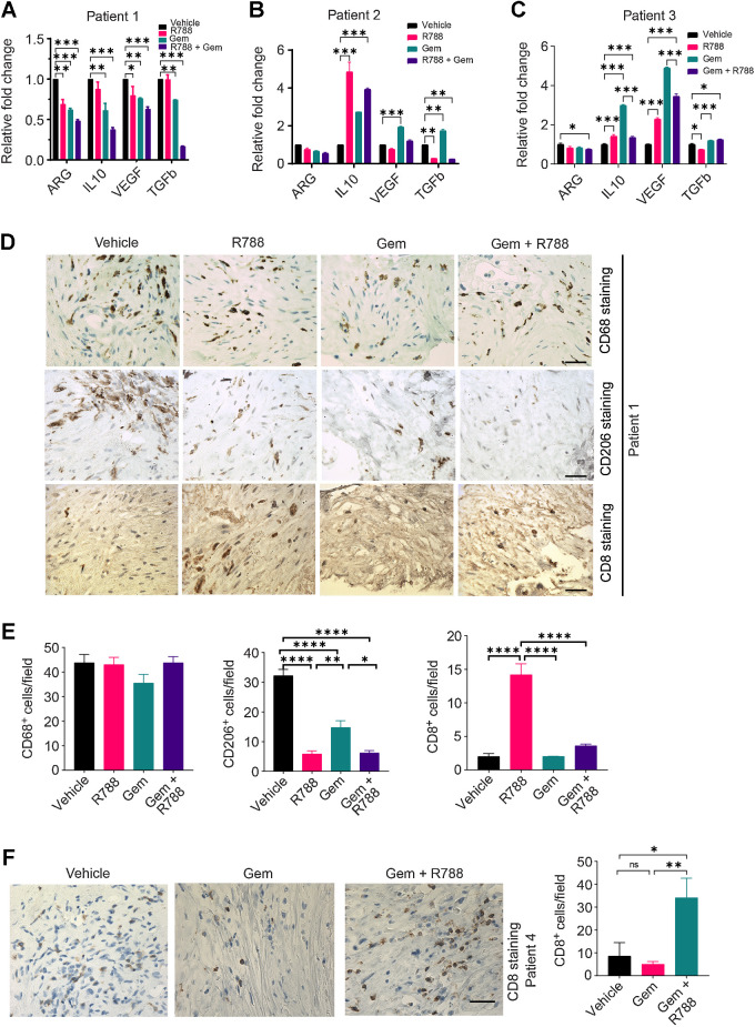 Figure 7. R788 reduces the expression of markers associated with immunosuppressive TAMs and augments immunostimulatory responses in human PDAC slice culture ex vivo. A–C, Relative mRNA expression of immunosuppressive genes in the human PDAC slices treated with either 250 nmol/L Gem and/or 2.5 μmol/L R788 from patient 1 (A), patient 2 (B), and patient 3 (C). Significance testing was performed by one-way ANOVA with Tukey post hoc multiple pairwise testing. D and E, IHC (D) of human PDAC slices derived from donor 1 for CD206+, CD68+ macrophages, and CD8+ T cells (scale bar, 20 μm) and quantification (E) of CD68+, CD206+, and CD8+ cells/40× field. F, IHC of human PDAC slices derived from patient 4 for CD8+ T cells. Scale bar, 20 μm. *, P < 0.05; **, P < 0.01; ***, P < 0.001; ****, P < 0.0001; ns, not significant.