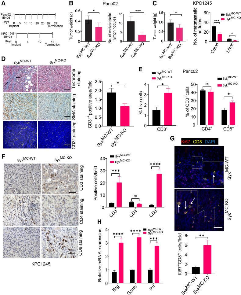 Figure 2. Macrophage Syk regulates immunosuppression, PDAC growth, and metastasis. A, Panc02 and KPC1245 tumors were orthotopically implanted into SykMC-WT and SykMC-KO mice according to the depicted schema. B and C, Left, weights of pancreata containing Panc02 (B) or KPC1245 (C) tumors from SykMC-WT and SykMC-KO mice. Right panels of B and C show quantification of metastatic nodules in colonic lymph nodes and liver. Significance testing was performed by nonparametric t tests. D, Left, representative images showing trichrome, αSMA, and CD31 staining in KPC1245 PDAC tumors. Scale bar, 50 μm. Right, CD31 quantification. E, FACS quantification of CD3+, CD4+, and CD8+ T cells in Panc02 PDAC tumors. F, Left, IHC of KPC1245-PDAC tumors for CD3, CD4+, and CD8. Scale bar, 20 μm. Right, immunodetection of T cells/microscopic field (n = 3). G, Top, IF staining of CD8 (yellow), DAPI (blue), and Ki67 (red) in KPC1245-PDAC tumors. Bottom, quantification data. Scale bar, 10 μm. H, mRNA expression of Ifng, Gzm, and Prf in orthotopic SykMC-WT and SykMC-KO Panc02 tumors. Statistical significance was determined using the Student t test or one-way ANOVA with Tukey post hoc multiple pairwise testing when analyzing more than two groups. *, P < 0.05; **, P < 0.01; ***, P < 0.001; ****, P < 0.0001; ns, not significant.