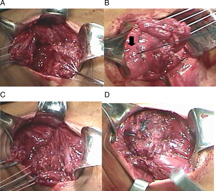 Figure 2