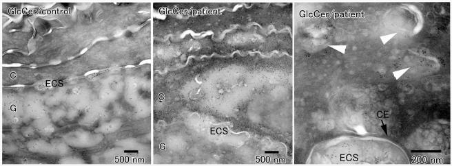 Figure  5