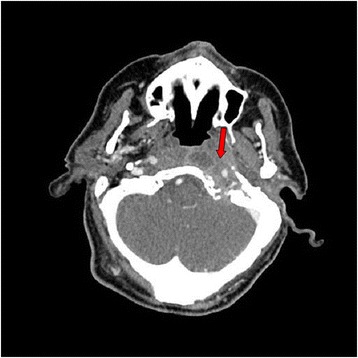 Fig. 2