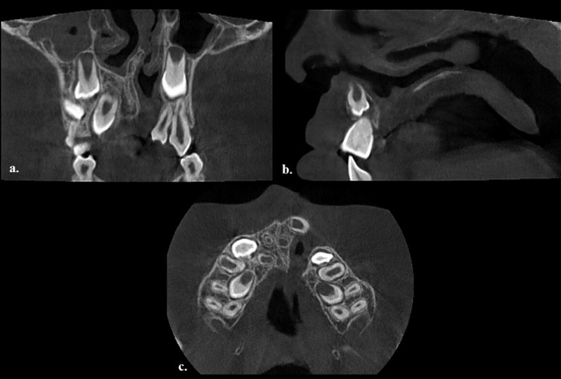 Fig. 2