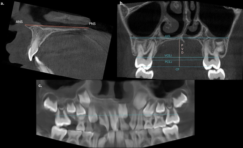 Fig. 3