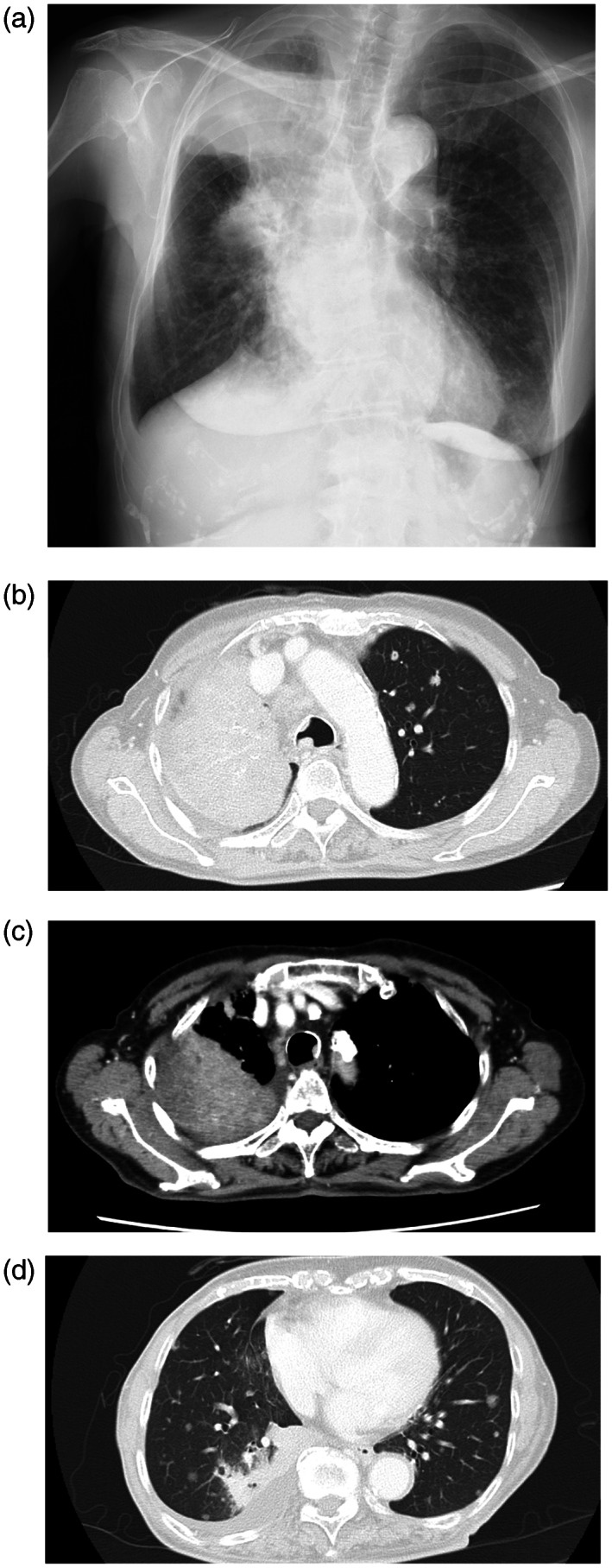 FIGURE 1