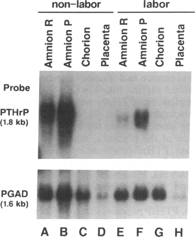 graphic file with name pnas01091-0547-a.jpg