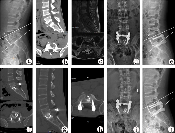 Fig. 2