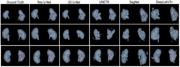 Figure 17