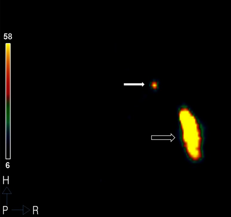 Fig. 10