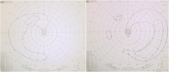 Fig. 4