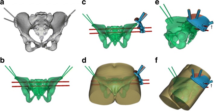 Fig. 3