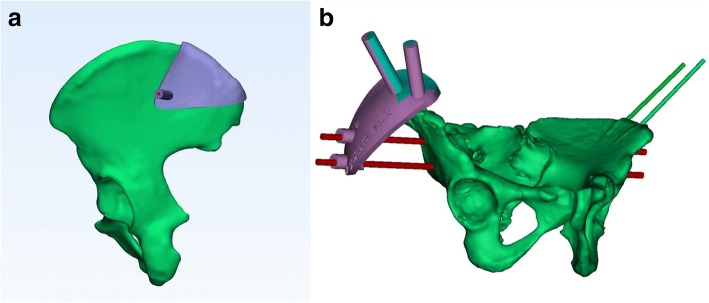 Fig. 1